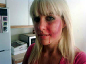 Jodi Byrne Special FX Makeup Artist Beat up Woman